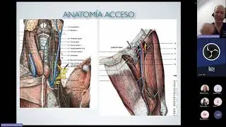 Webinar 