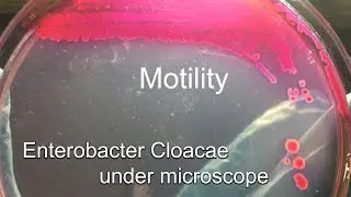 Подвижные бактерии вида Enterobacter Cloacae