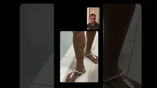 Por que n&atilde;o usamos espuma em veias grandes?