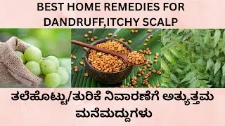 DANDRUFF HOME REMEDIES  IN KANNADA.HOME REMEDIES  TO GET RID OF ITCHY SCALP,DANDRUFF IN KANNADA