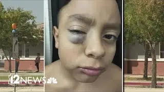 2 Valley parents say son's school didn't do enough to protect their 10-year-old attacked by another