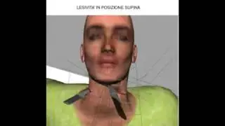 Proof of Multiple Attackers in Murder of Meredith Kercher