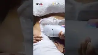 Menghilangkan Lemak Dalam Waktu Singkat PREMIER Fat Freeze360