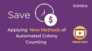 Automated Colony Counting – New Methods Can Save Researchers Time and Cost