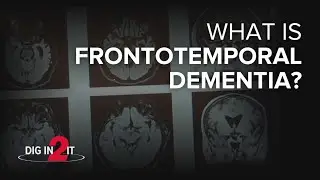 What is frontotemporal dementia? Explaining Bruce Willis' diagnosis