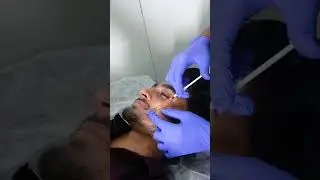 Roshan | PRP |  Maynee Cosmetology Clinic