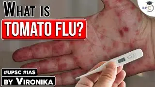 What is Tomato Flu & its symptom? | Tomato flu outbreak in Kerala | Know all about it | UPSC