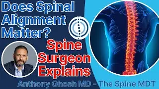 Does spinal alignment matter? Spine surgeon explains