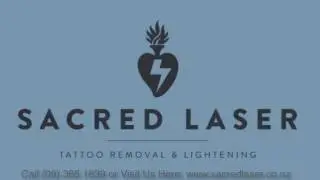 Laser Tattoo Removal Results After Treatment   Call 09 365 1839 Sacred Laser Auckland NZ