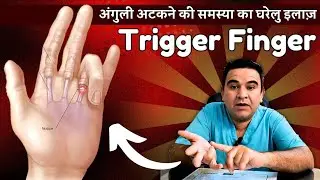 Home Remedies for Trigger Finger: Heal Your Hands Naturally!