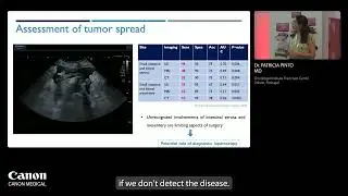 ISUOG 2024 - Д-р Патрисия Пинто - Оценка резектабельности тубулярного рака яичников с помощью УЗИ