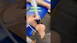 💥 Calcific Tendinitis in the Achilles Tendon? There is Treatment! #physiotherapy #heelspur #pain