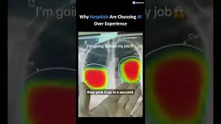 Radiologists Are Being Replaced by AI &mdash; Here's What That Means.  #shorts