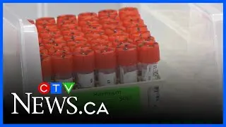 Attempt to privatize lab services cost Albertans $109M: AG