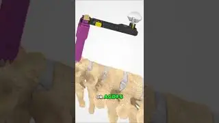 Spine Surgery Instruments and Techniques