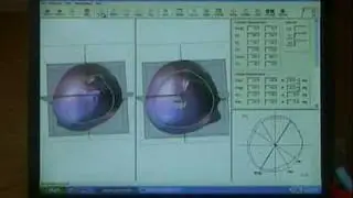 StarScanner Part 8