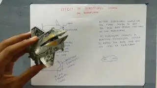 Effect of gyroscopic couple on aeroplane solved in an easy way.