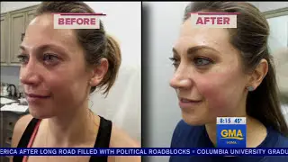 Dermatologist shares how to treat the 