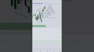 !! Understand this or you FAIL !! Losing trades. ICT 2025 SPEECH #tradinglosses #easytrade #forex