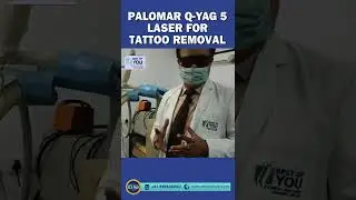 Palomar Q YAG 5 Laser for Tattoo Removal, Best Laser for Tattoo Removal in Delhi | Dr. PK Talwar