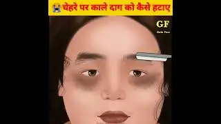 😭चेहरे पर काले दाग को कैसे हटाए#asmr #brainasmr #facts #animation #anime @BrainzFacts
