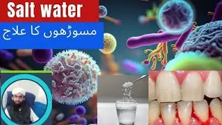 Gum Infection Home Remedies |Toothache Home Remedies |Gingivitis Cleaning | Gargles @HealthyHamesha