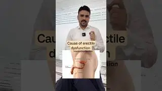cause of erectile dysfunction