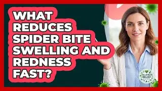 What Reduces Spider Bite Swelling And Redness Fast? - Allergy Relief Guide