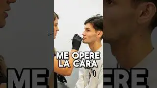 ME OPER&Eacute; LA CARA Y ESTE ES MI NUEVO YO&hellip; #asmr #shorts #asmrvideo