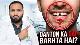 Danton Mein Gap Kyun Banta Hai? | The SHOCKING Truth About Gaps Between Teeth Nobody Tells You