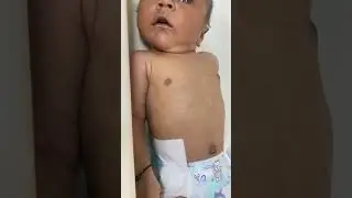 Newborn with grunting & respiratory distress #newborn #shorts #babyvideos #grunt #pediatrics