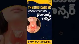 థైరాయిడ్ కాన్సర్ యొక్క లక్షణాలు | Thyroid Cancer Signs & Symptoms | Health Tips | Roy Tv Health