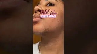 Pcos chin wax #pcos #chinwax
