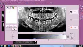 Insights Diagnostic - iRys Software Tutorial Video - 2D Image Enhancement