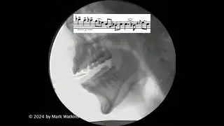Video16 Terminal Vibrato&mdash;Lessons From the Master, Charlie Parker