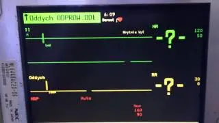 HP Viridia M3 -Damaged patient monitor (Polish software)