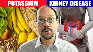 Potassium and Kidney Disease | How To Lower Your Potassium Levels Video #2