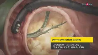 Endoscopic Retrograde Cholangiopancreatography (ERCP) | Procedure and Product Overview