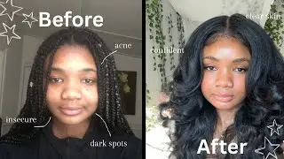 We don&rsquo;t gatekeep over here| how I actually ✨glowed up ✨ (the real tea)
