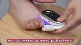 Nail Fungus Laser Treatment Device