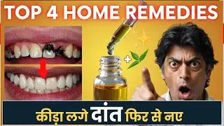4 Unknown Home Remedies That Stop Tooth Cavity | Dental Carries