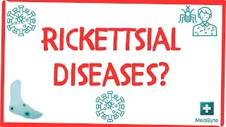 What are Rickettsial Diseases? 🦠