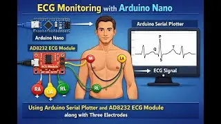 Мониторинг ЭКГ с помощью Arduino Nano