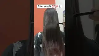 after result dekh Lo hair treatment ka 😍 || hair problem solve females #hairstyle #viralvideo#shorts