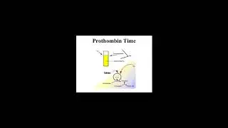 [Wikipedia] Thrombin time