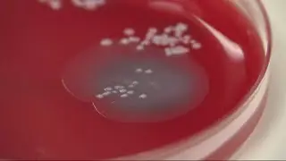 Bacteria experiment at MCG Microbiology Lab