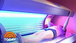 Major Spike In Female Skin Cancer Rates Points To Tanning Trends | TODAY