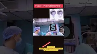 #prostate #bph #treatment #turp #laser #holep #best #kathmandu #nepal #urologist