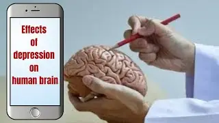 Effects of Depression on the Human Brain