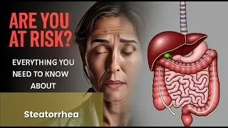Steatorrhea Explained Causes, Symptoms and Treatment, All Insights